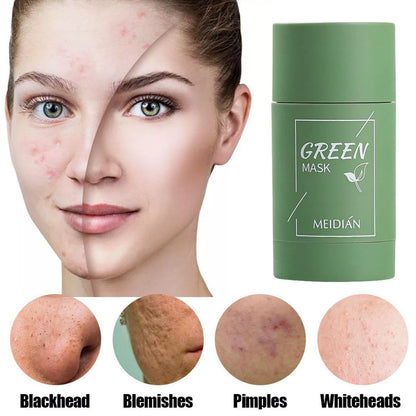 Green Tea Solid Cleansing Mask Acne Blemish Treatment Cream Blackhead Removal Natural Plant Formula Mild Skincare Solution